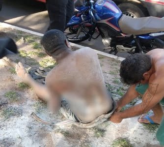 Homem tem o corpo queimado após motocicleta pegar fogo em São Luís￼