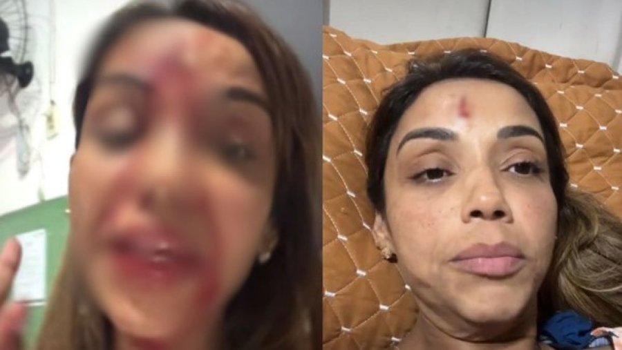 Cantora piauiense publica vídeo com rosto sangrando e denuncia agressão do ex-marido